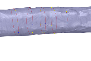 Stent function